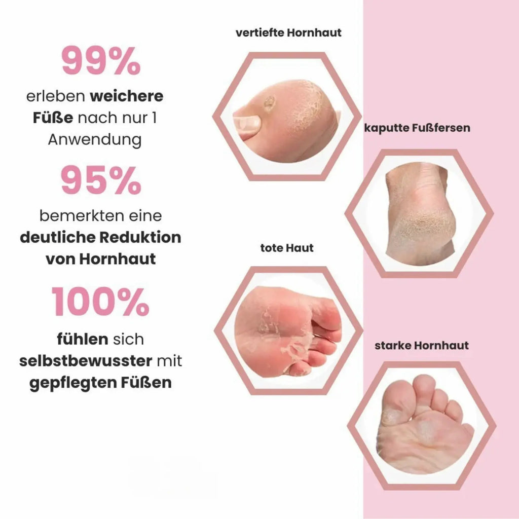 DermaRein Pro inkl. 60 Glide Pads (Gratis) Hornhautentfernung Dermarein