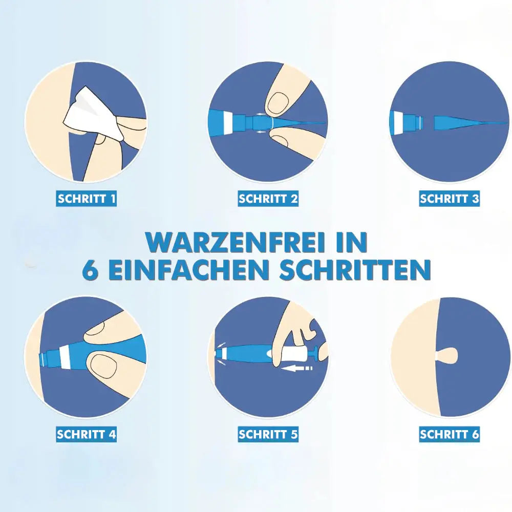 Warzenfrei   -   Der   Stielwarzen   entferner Mein Shop