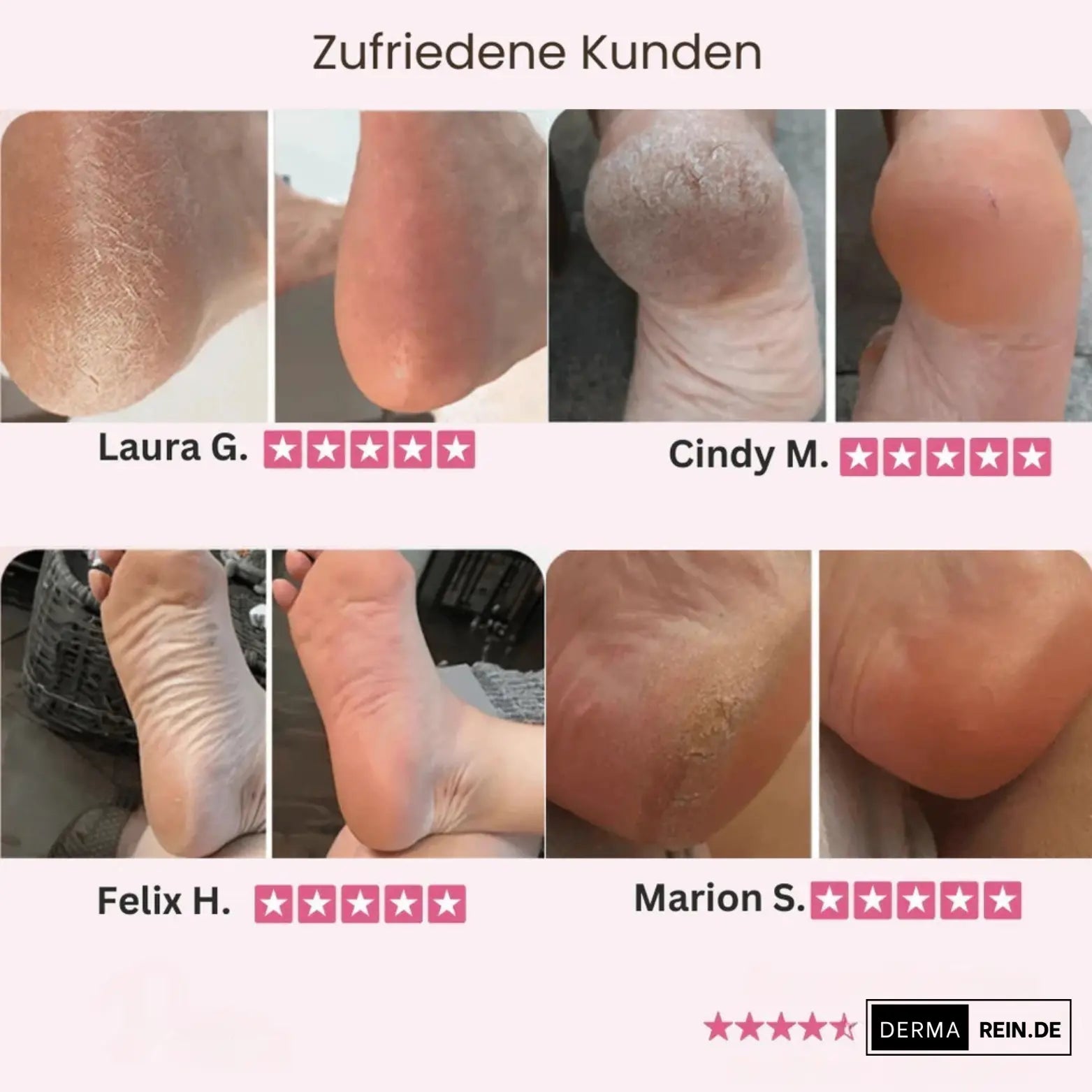 Hornhautentferner in Anwendung am Fuß